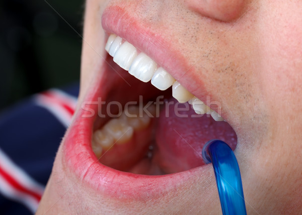 Dental verificare up clinica mano Foto d'archivio © ocskaymark