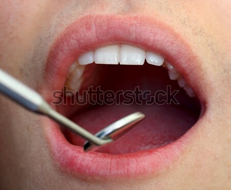 Dental examination Stock photo © ocskaymark