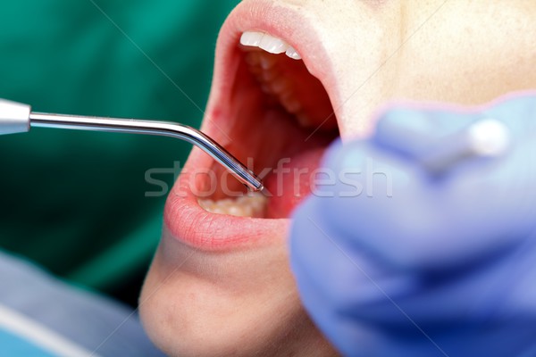 Dental examination Stock photo © ocskaymark