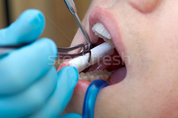 Stockfoto: Tandheelkundige · boren · tandarts · boor · tand · turbine