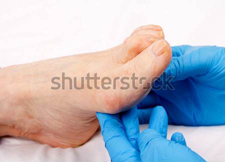 ältere Fuß Bild Krankenschwester Hand halten Stock foto © ocskaymark