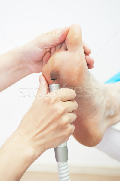 foot procedure Stock photo © olira
