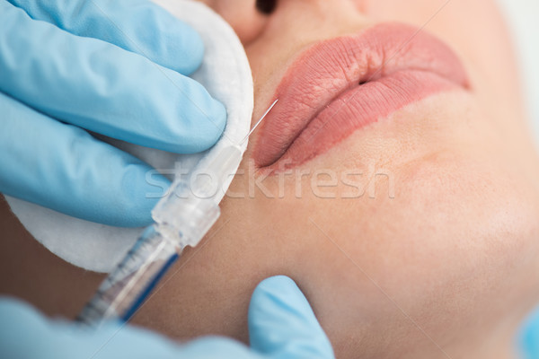 Vrouw injectie lippen handen gezicht Stockfoto © olira