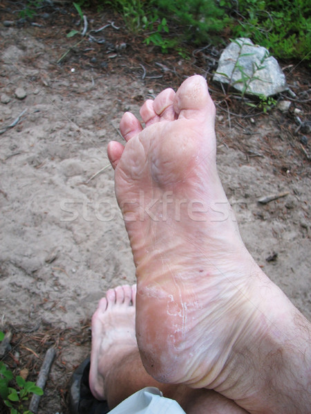 worn out foot Stock photo © pancaketom