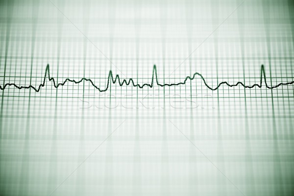 Elektrokardiogramm Papier Form Herz Körper Stock foto © pedrosala