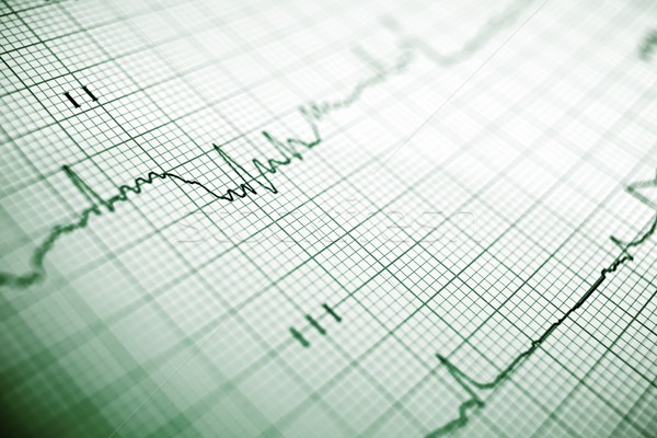 Electrocardiogram Stock photo © pedrosala