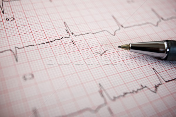 [[stock_photo]]: électrocardiogramme · papier · forme · médicaux · coeur