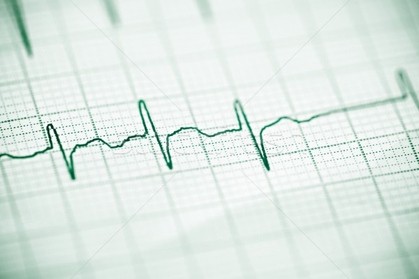 Electrocardiograma hârtie formă inimă corp Imagine de stoc © pedrosala