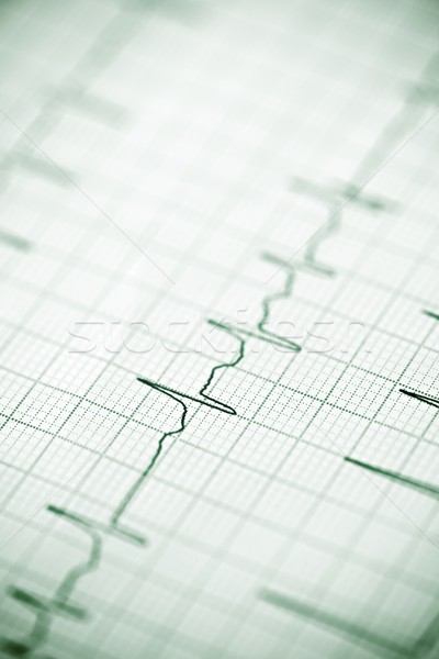 Electrocardiogram Stock photo © pedrosala