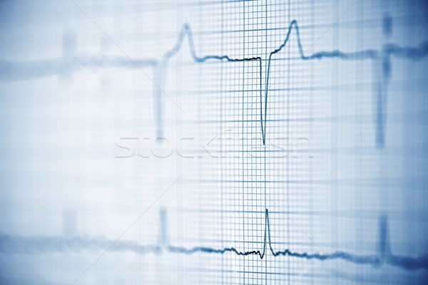 Elektrokardiogramm Papier Form medizinischen Herz Stock foto © pedrosala