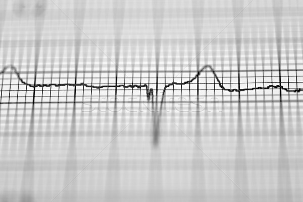 Elektrokardiogram közelkép papír űrlap orvosi szív Stock fotó © pedrosala