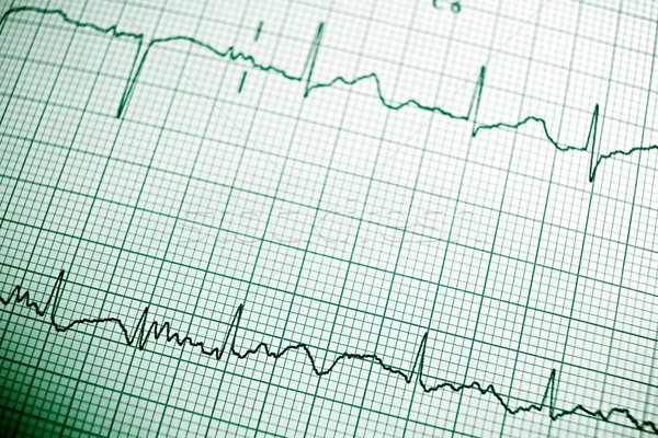 Electrocardiogram Stock photo © pedrosala