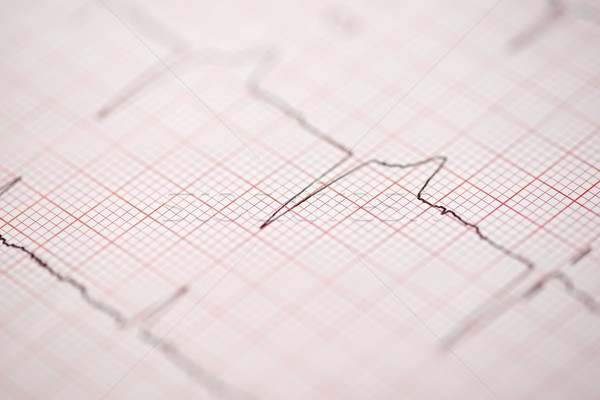 Elektrokardiyogram kâğıt form tıbbi kalp Stok fotoğraf © pedrosala