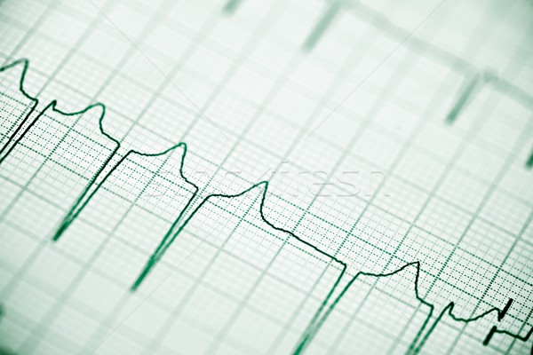Stockfoto: Elektrocardiogram · papier · vorm · hart · lichaam