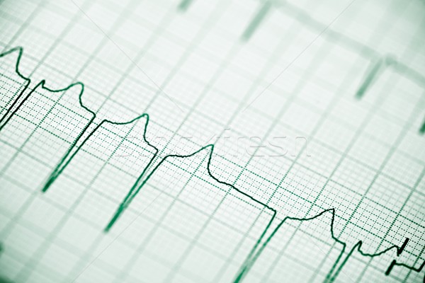 Electrocardiograma papel forma corazón cuerpo Foto stock © pedrosala