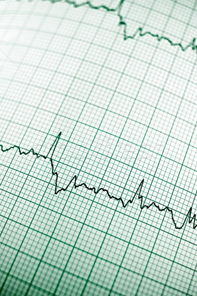 Electrocardiogram Stock photo © pedrosala