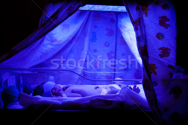 Baby under Phototherapy Stock photo © phakimata