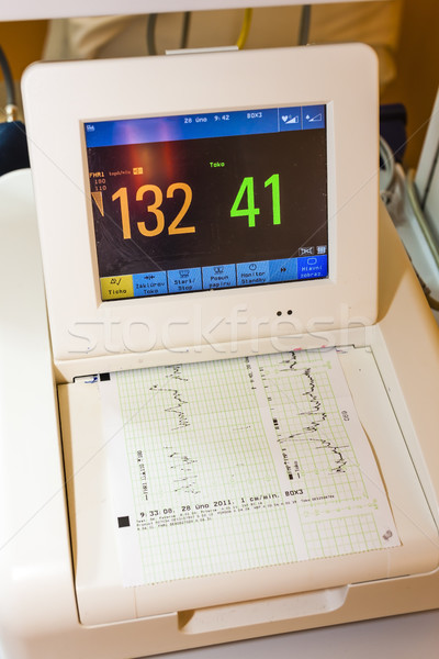 monitor for measuring of labor contractions Stock photo © phbcz