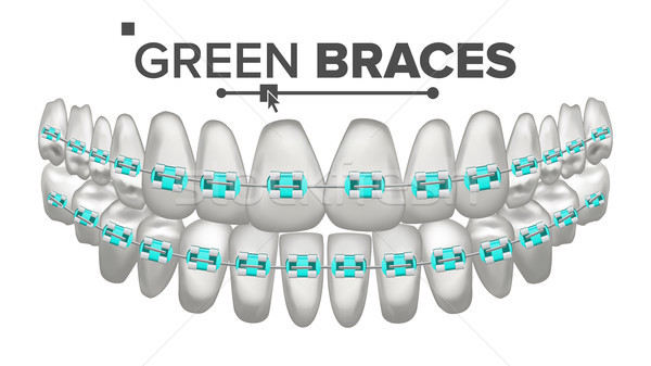 Stock photo: Green Child Braces Vector. Tooth And Dental Braces. Human Jaw. 3D Realistic Isolated Illustration