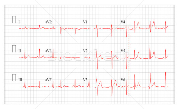 Hart kardiogram grafiek vector ingesteld gezond hart Stockfoto © pikepicture
