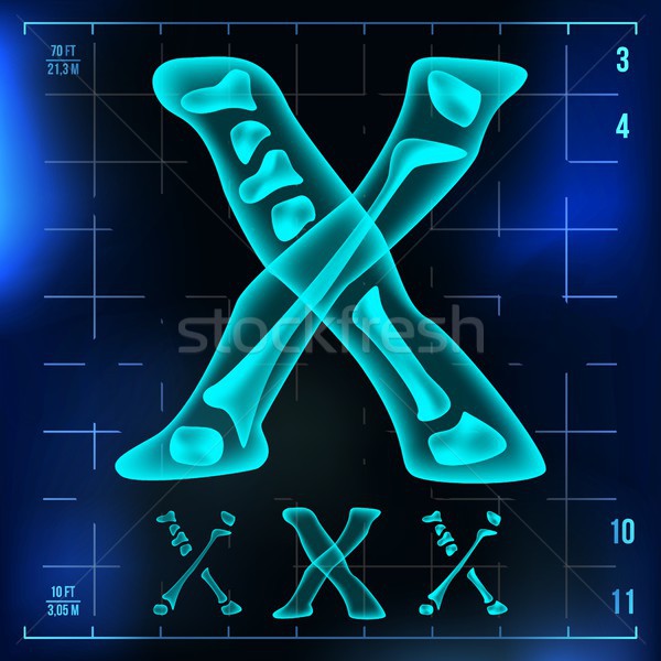 X Letter Vector. Capital Digit. Roentgen X-ray Font Light Sign. Medical Radiology Neon Scan Effect.  Stock photo © pikepicture