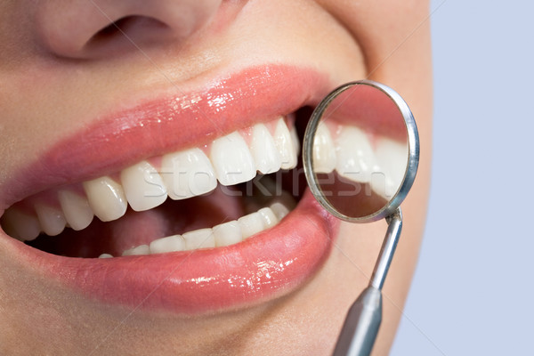 Nice teeth Stock photo © pressmaster