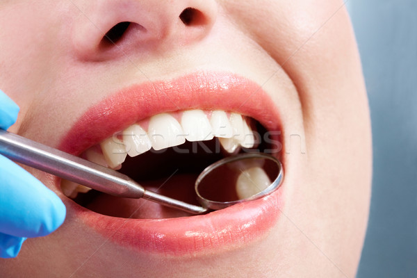Gură pasă deschide oral dentist Imagine de stoc © pressmaster