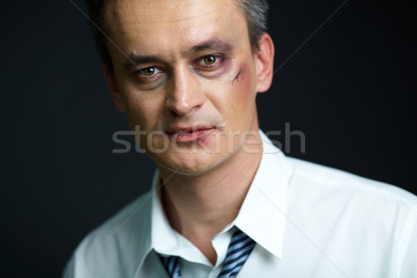 Foto stock: Negocios · luchador · retrato · empresario · contusión · mirando