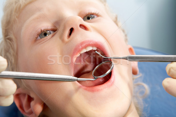Zahnpflege Foto wenig Junge Mund zahnärztliche Stock foto © pressmaster
