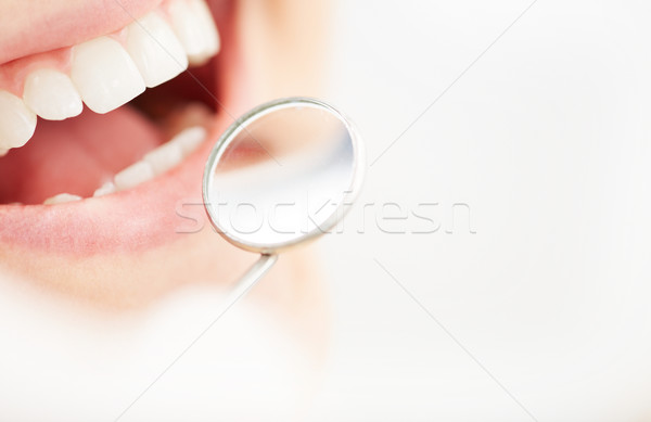 Sani denti primo piano open bocca orale Foto d'archivio © pressmaster