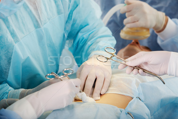 Instrument hand assistent medische geneeskunde Stockfoto © pressmaster