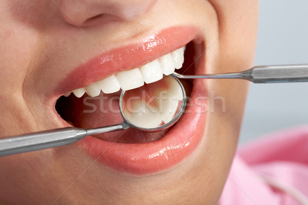 рот пациент стоматолога белый инструментом Сток-фото © pressmaster
