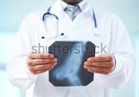 X-ray of foot Stock photo © pressmaster