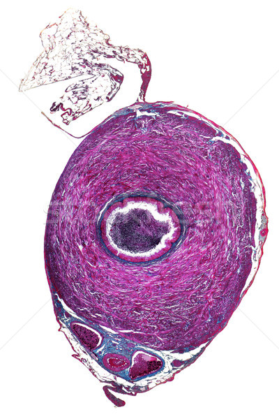 ductus deferens micrography Stock photo © prill