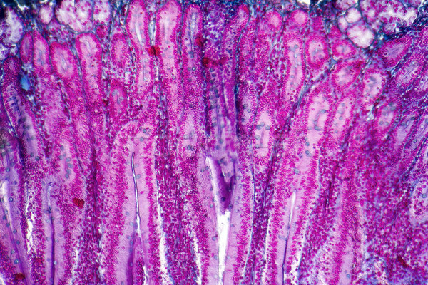 duodenum cross section Stock photo © prill