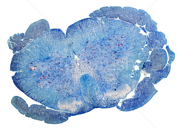 Stockfoto: Spinale · koord · doorsnede · Blauw · gekleurd · microscopisch