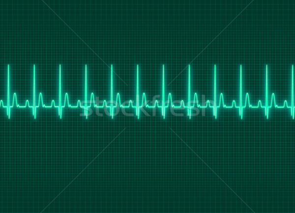 Electrocardiography Stock photo © prill