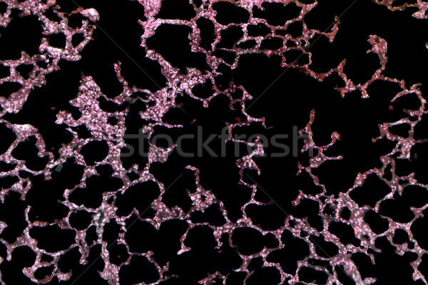Polmone tessuto primo piano microscopica dettaglio Foto d'archivio © prill