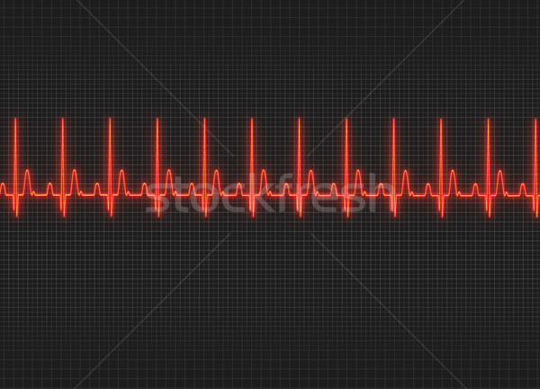 Electrocardiography Stock photo © prill