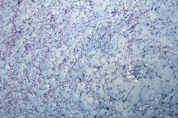 Urinary bladder micrograph Stock photo © prill
