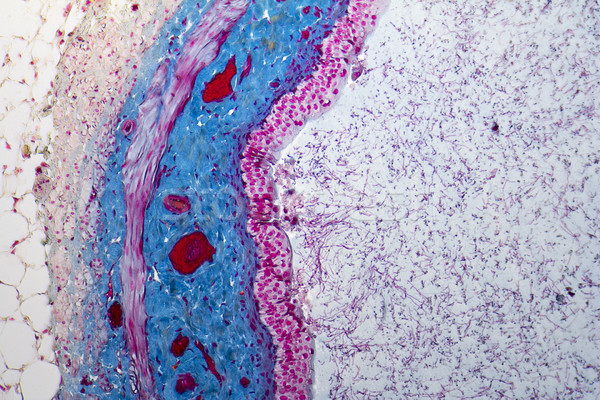 Urinary bladder micrograph Stock photo © prill