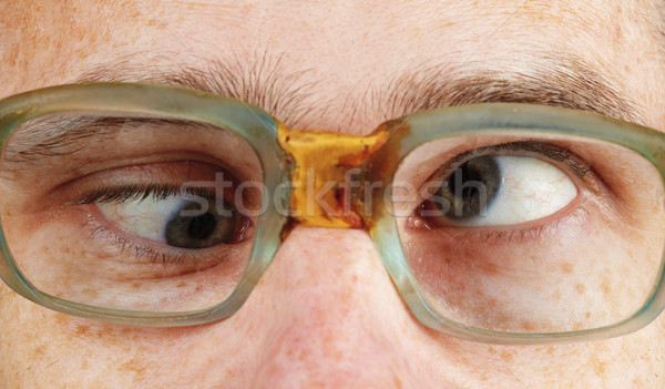 Stock photo: Cross-eyed person in old-fashioned spectacles