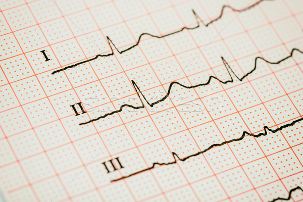 Sinus Herz Rhythmus Elektrokardiogramm Eintrag Papier Stock foto © radub85