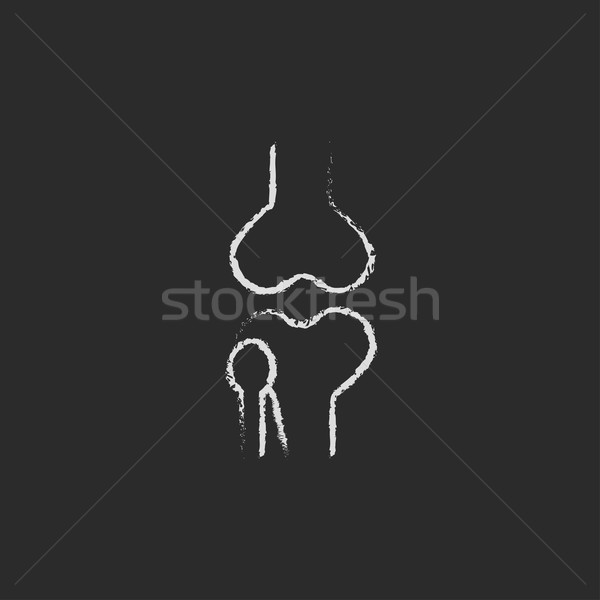 Stock photo: Knee joint icon drawn in chalk.