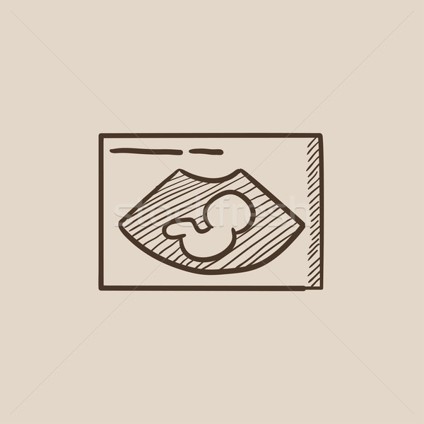Fetal ultrasound sketch icon. Stock photo © RAStudio