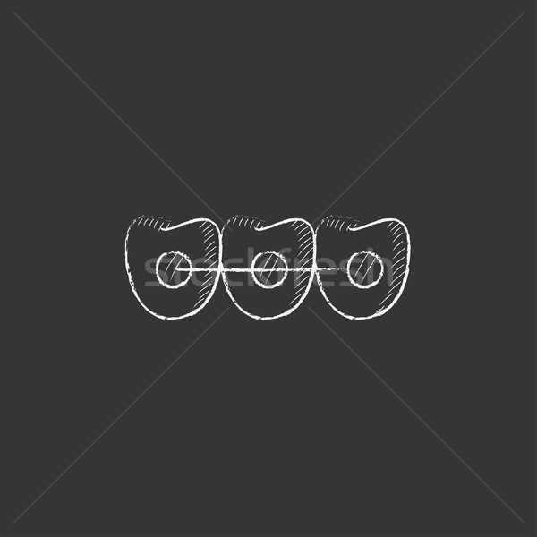 Orthodontic braces. Drawn in chalk icon. Stock photo © RAStudio
