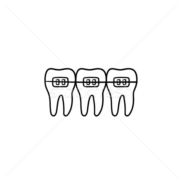 Dental braces hand drawn outline doodle icon. Stock photo © RAStudio