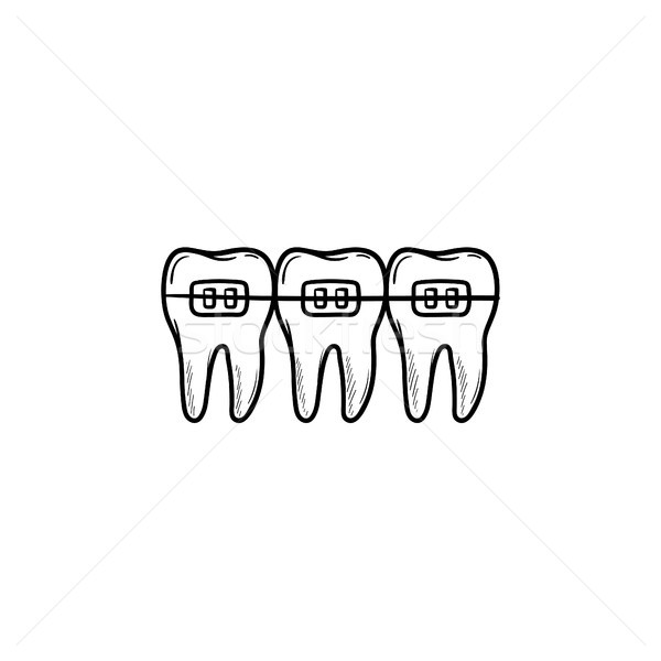 Stock photo: Dental braces hand drawn outline doodle icon.