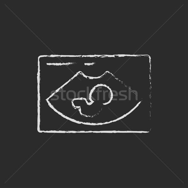Fetal ultrasound icon drawn in chalk. Stock photo © RAStudio