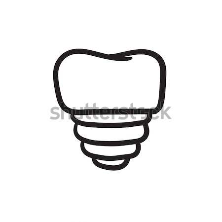 Dinte implant schiţă icoană vector izolat Imagine de stoc © RAStudio
